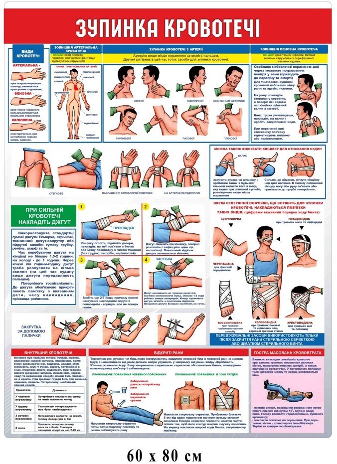 Стенд в клас безпеки "Зупинка кровотечі"